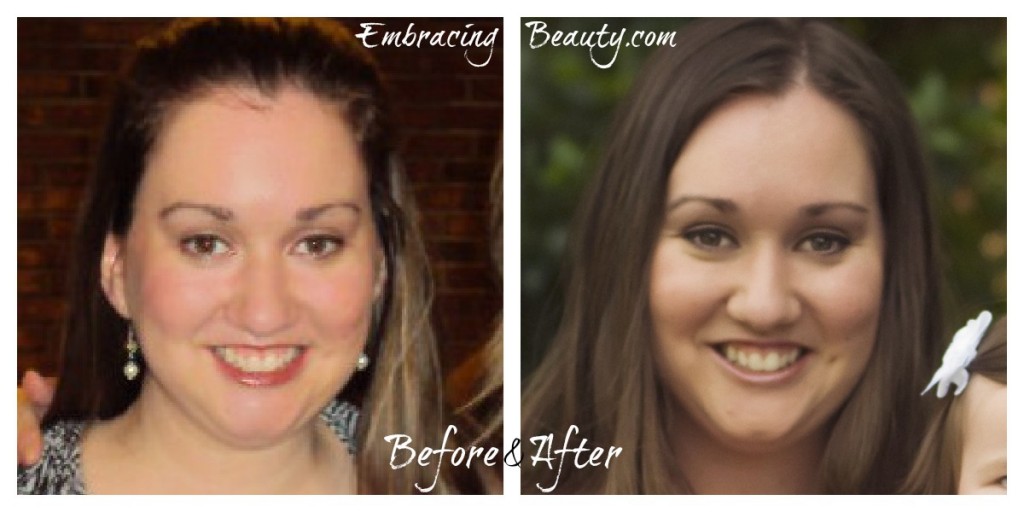 Facial Weight Loss Before And After
