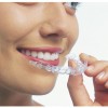 invisalign