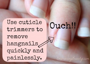 How to Remove Hangnails!