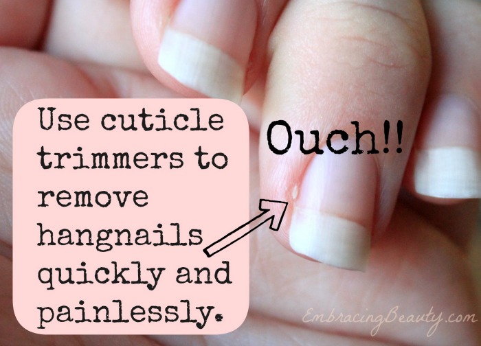 How to Remove Hangnails!!